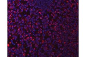 IF analysis of SUCLG1 using anti-SUCLG1 antibody (ABIN7600906). (SUCLG1 抗体  (AA 25-346))