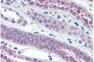 Human Kidney (formalin-fixed, paraffin-embedded) stained with TJP3 antibody ABIN364296 at 10 ug/ml followed by biotinylated goat anti-rabbit IgG secondary antibody ABIN481713, alkaline phosphatase-streptavidin and chromogen. (TJP3 抗体  (C-Term))