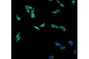 IF analysis of Beta Tubulin using anti-Beta Tubulin antibody (ABIN7602743).