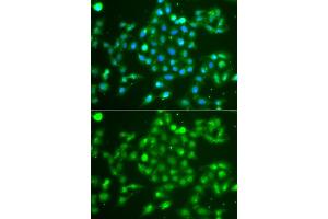 Immunofluorescence analysis of  cells using UCHL5 antibody (ABIN6132764, ABIN6149872, ABIN6149874 and ABIN6223990).