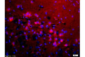 Formalin-fixed and paraffin-embedded rat brain labeled with Anti-KMT8/Riz1/Riz2 Polyclonal Antibody, Unconjugated (ABIN763001) 1:200, overnight at 4°C, The secondary antibody was Goat Anti-Rabbit IgG, Cy3 conjugated used at 1:200 dilution for 40 minutes at 37°C. (PRDM2 抗体  (AA 1201-1300))