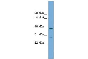 WB Suggested Anti-NCF4 Antibody Titration: 0. (NCF4 抗体  (C-Term))