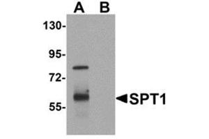 Western blot analysis of TYW1 in human lung tissue lysate with TYW1 antibody at 1 μg/ml. (TYW1 抗体  (C-Term))