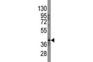 Western Blotting (WB) image for anti-SRY (Sex Determining Region Y)-Box 2 (SOX2) (AA 89-119) antibody (ABIN3032736)