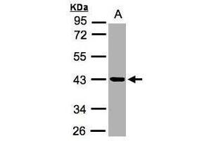 WB Image Sample (30μg whole cell lysate) A:MOLT4 , 10% SDS PAGE antibody diluted at 1:2000 (Kallikrein 11 抗体)
