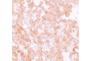 Immunohistochemical staining of rat lung cells with MFSD2 polyclonal antibody  at 5 ug/mL. (MFSD2A 抗体  (C-Term))