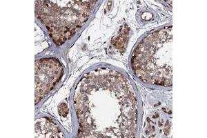 Immunohistochemical staining of human testis with N4BP1 polyclonal antibody  shows strong cytoplasmic positivity in cells in seminiferus ducts / spermatogonia at 1:50-1:200 dilution. (N4BP1 抗体)