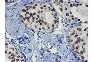 Image no. 7 for anti-SUMO1/sentrin/SMT3 Specific Peptidase 2 (SENP2) (AA 139-523) antibody (ABIN1490926)