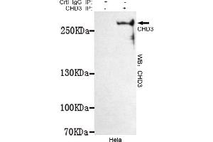 Immunoprecipitation analysis of Hela cell lysates using CHD3 mouse mAb. (CHD3 抗体  (C-Term))