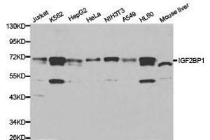 Western Blotting (WB) image for anti-Insulin-Like Growth Factor 2 mRNA Binding Protein 1 (IGF2BP1) antibody (ABIN1873165) (IGF2BP1 抗体)