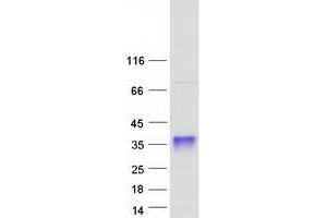 Western Blotting (WB) image for SSU72 RNA Polymerase II CTD Phosphatase Homolog (SSU72) protein (Myc-DYKDDDDK Tag) (ABIN2732715)