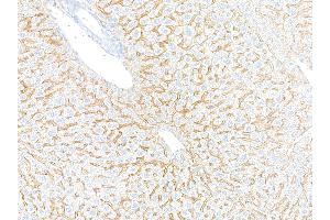 Immunohistochemistry (IHC) image for anti-Epidermal Growth Factor Receptor (EGFR) (C-Term) antibody (ABIN7795642)