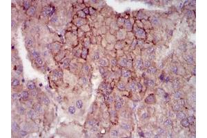 Immunohistochemistry (IHC) image for anti-Maternal Embryonic Leucine Zipper Kinase (MELK) antibody (ABIN1108210) (MELK 抗体)