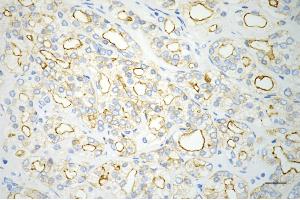 anti-IQ Motif Containing GTPase Activating Protein 2 (IQGAP2) antibody