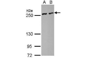 WB Image NuMA antibody [N1], N-term detects NUMA1 protein by Western blot analysis. (NUMA1 抗体  (N-Term))