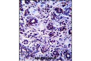 DHX32 Antibody (Center) (ABIN657498 and ABIN2846523) immunohistochemistry analysis in formalin fixed and paraffin embedded human breast tissue followed by peroxidase conjugation of the secondary antibody and DAB staining. (DHX32 抗体  (AA 342-371))