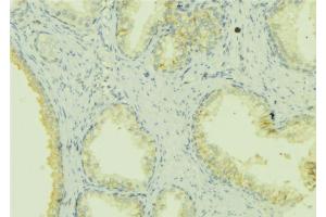ABIN6272851 at 1/100 staining Mouse colon tissue by IHC-P. (SHARPIN 抗体  (Internal Region))