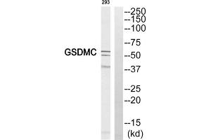 Western blot analysis of extracts from 293 cell, using GSDMC antibody. (MLZE 抗体  (Internal Region))