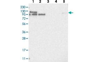 Western blot analysis of Lane 1: RT-4, Lane 2: U-251 MG, Lane 3: Human Plasma, Lane 4: Liver, Lane 5: Tonsil with LARP5 polyclonal antibody  at 1:250-1:500 dilution. (LARP4B 抗体)