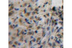 IHC-P analysis of Ovary tissue, with DAB staining. (AFT1 抗体  (AA 3-213))