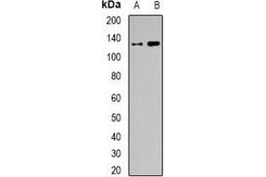 Western blot analysis of BAF155 expression in SW620 (A), HEK293T (B) whole cell lysates. (SMARCC1 抗体)