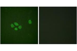 Immunofluorescence analysis of A549 cells, using SOX-9 (Phospho-Ser181) Antibody. (SOX9 抗体  (pSer181))