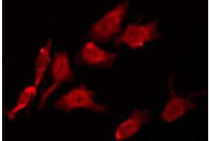 ABIN6274225 staining Hela by IF/ICC. (LTK 抗体  (Internal Region))