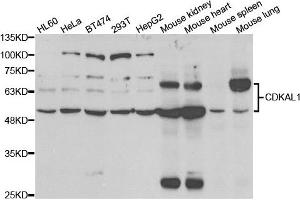 Western blot analysis of extracts of various cell lines, using CDKAL1 antibody. (CDKAL1 抗体)