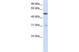 WB Suggested Anti-AGXT2L2 Antibody Titration:  0. (AGXT2L2 抗体  (N-Term))
