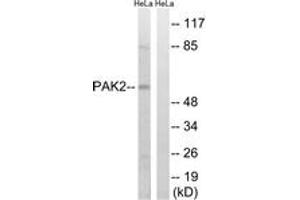 Western blot analysis of extracts from HeLa cells, treated with TSA 400nM 24H, using PAK2 (Ab-141) Antibody. (PAK2 抗体  (AA 107-156))