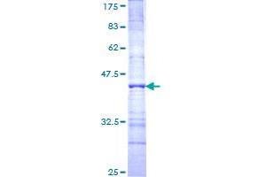 PNN Protein (AA 201-300) (GST tag)