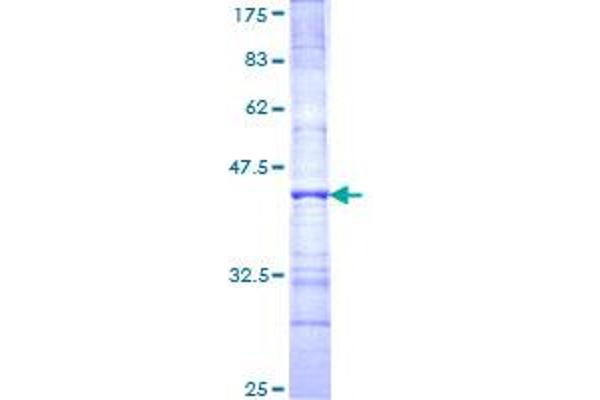 PNN Protein (AA 201-300) (GST tag)