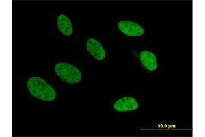 Immunofluorescence of purified MaxPab antibody to TRA2A on HeLa cell. (TRA2A 抗体  (AA 1-282))
