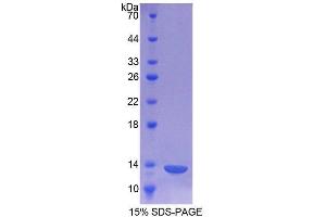 SDS-PAGE analysis of Human CHRNa1 Protein. (CHRNA1 蛋白)