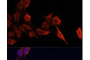 Immunofluorescence analysis of HeLa cells using TIMP1 Polyclonal Antibody at dilution of 1:100. (TIMP1 抗体)