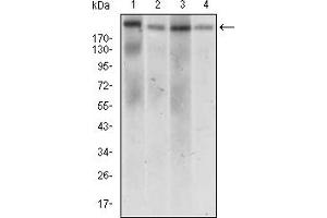 Fig. (DNMT1 抗体  (AA 1448-1594))