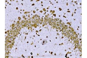 IHC analysis of BRSK1 using anti-BRSK1 antibody (ABIN7600990). (BRSK1 抗体  (AA 269-321))