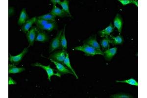 Immunofluorescent analysis of Hela cells using ABIN7168659 at dilution of 1:100 and Alexa Fluor 488-congugated AffiniPure Goat Anti-Rabbit IgG(H+L) (SEC23IP 抗体  (AA 779-989))