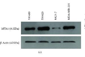 Protein expression of MTA1 by Western Blot analysis. (MTA1 抗体  (AA 601-715))