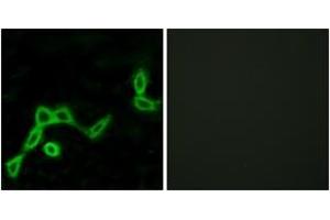 Immunofluorescence analysis of LOVO cells, using KISS1R Antibody. (KISS1R 抗体  (AA 301-350))
