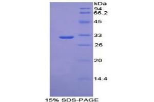 SDS-PAGE analysis of Mouse PCK1 Protein. (PCK1 Protein (Soluble))