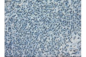 Immunohistochemical staining of paraffin-embedded lymphoma tissue using anti-PORmouse monoclonal antibody. (POR 抗体)