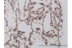 Immunoperoxidase of monoclonal antibody to FOXL1 on formalin-fixed paraffin-embedded human lung. (FOXL1 抗体  (AA 132-240))
