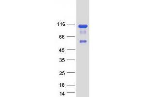 Western Blotting (WB) image for Oxysterol Binding Protein-Like 9 (OSBPL9) (Transcript Variant 7) protein (Myc-DYKDDDDK Tag) (ABIN2727994)