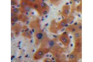 Used in DAB staining on fromalin fixed paraffin-embedded Liver tissue (IL17C 抗体  (AA 7-159))
