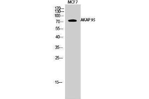 Western Blotting (WB) image for anti-A Kinase (PRKA) Anchor Protein 8 (AKAP8) (Internal Region) antibody (ABIN3173731) (AKAP8 抗体  (Internal Region))