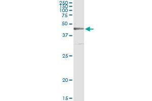 Immunoprecipitation of CRLF1 transfected lysate using anti-CRLF1 monoclonal antibody and Protein A Magnetic Bead , and immunoblotted with CRLF1 MaxPab rabbit polyclonal antibody. (CRLF1 抗体  (AA 135-230))