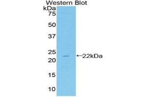Detection of Recombinant HSPb2, Mouse using Polyclonal Antibody to Heat Shock Protein Beta 2 (HSPb2) (HSPB2 抗体  (AA 12-170))