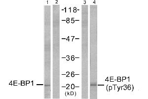 Western blot analysis of extracts from MDA-MB-435 cells, untreated or EGF-treated (200 ng/ml, 30min), using 4E-BP1 (Ab-36) antibody (Line 1 and 2) and 4E-BP1 (phospho-Thr36) antibody (Line 3 and 4). (eIF4EBP1 抗体  (pThr36))