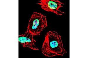 Fluorescent confocal image of Hela cell stained with HDAC1 Antibody (Center ) (ABIN1538397 and ABIN2848543). (HDAC1 抗体  (AA 402-430))
